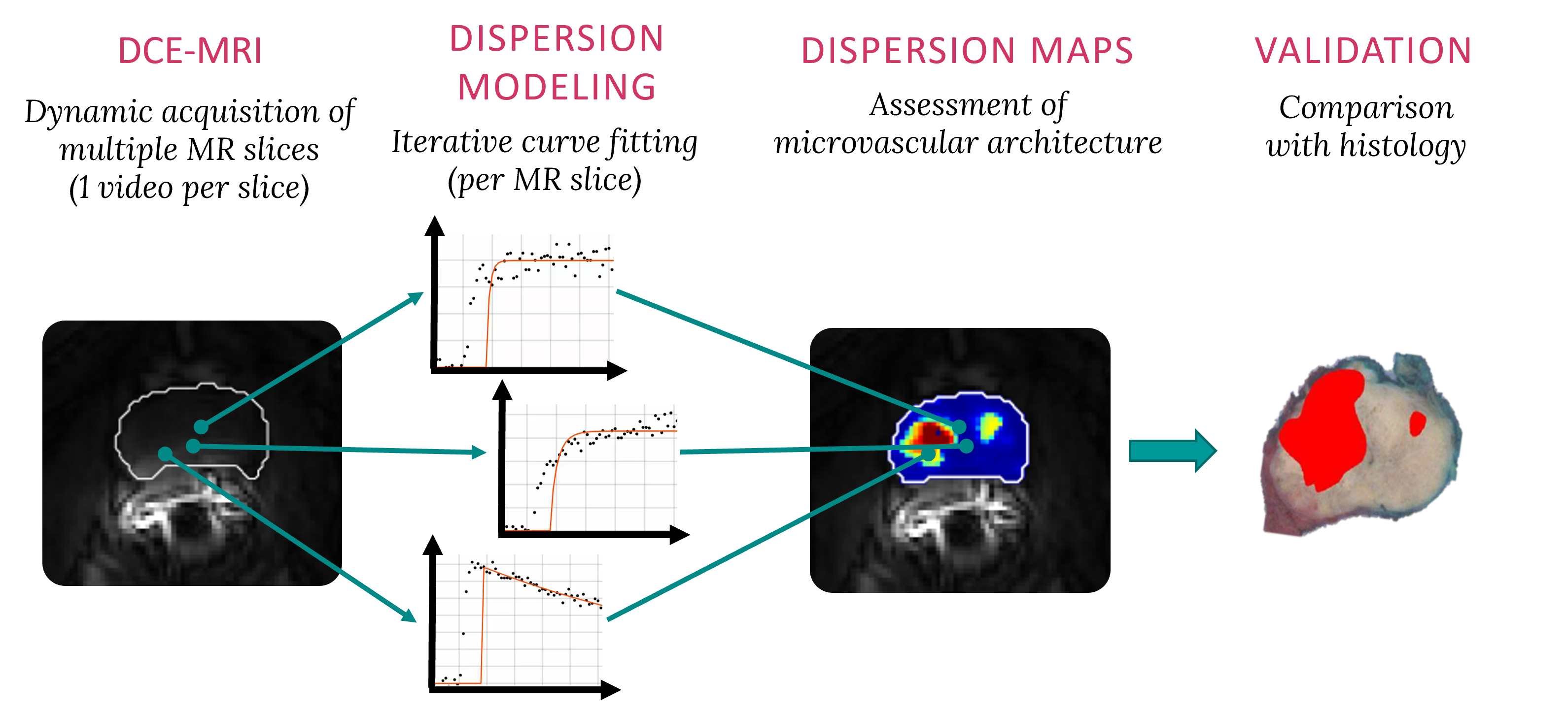 MRDI workflow