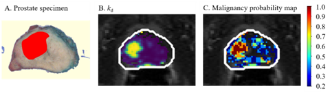 Radiomics analysis of DCE-MRI