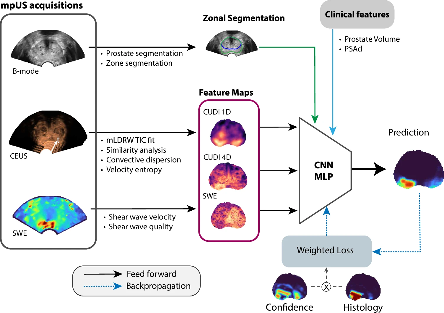 Diagram showing B-mode, CEUS and SWE acquisitions, extracted feature maps, clinical information, and a classifier producing a cancer-probability map.