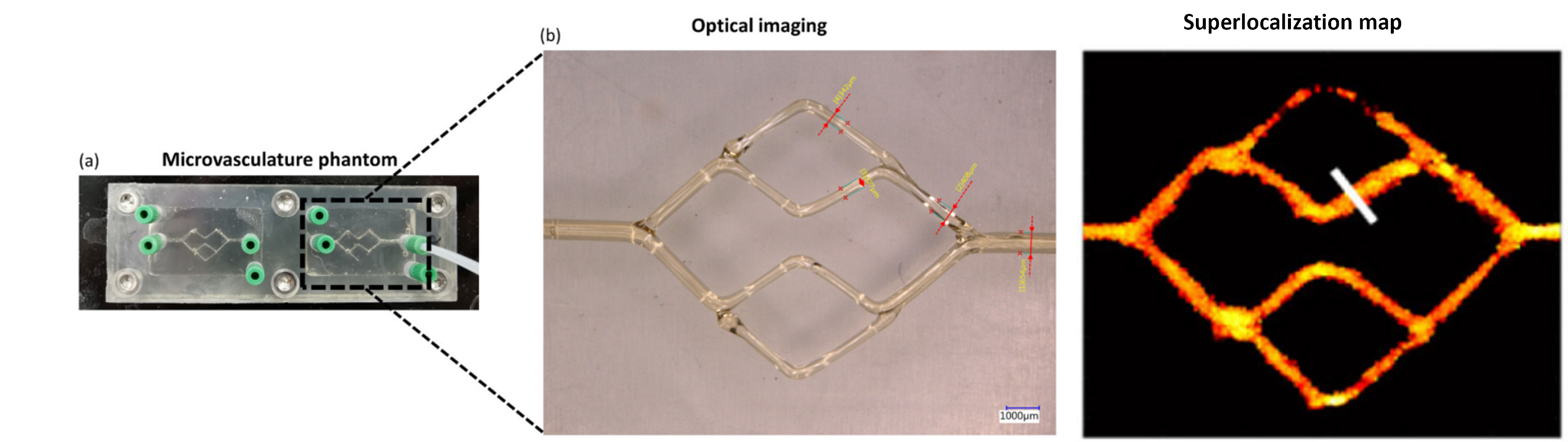 Example super-resolution imaging in bifurcating phantom